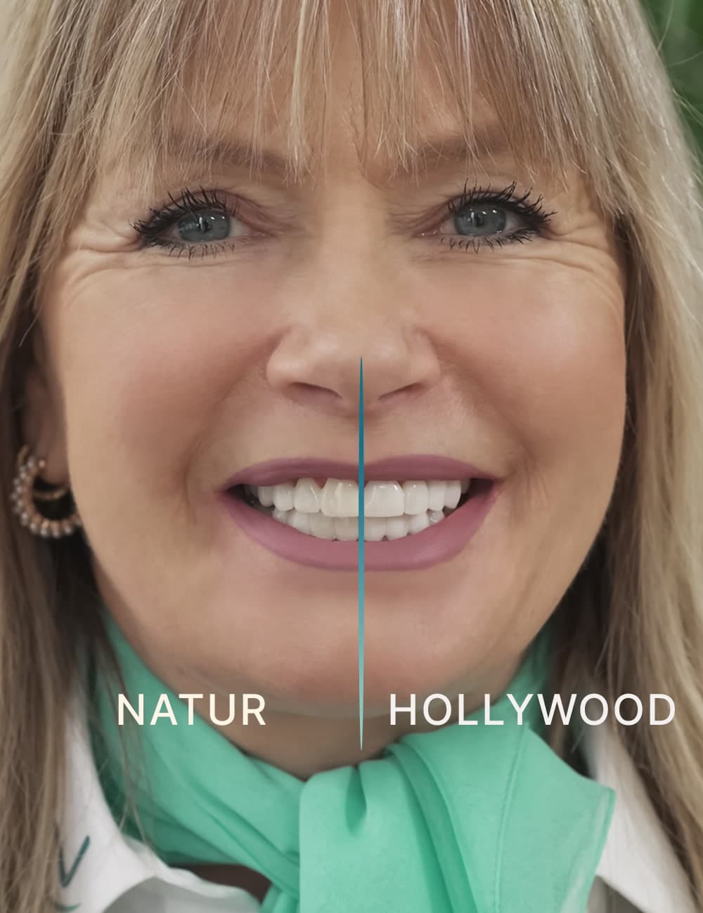Carilla-Dental