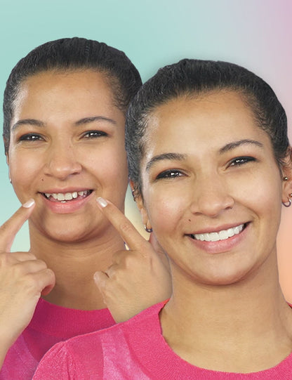 Carilla-Dental