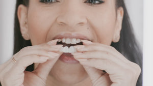 Veneera - Carilla-Dental